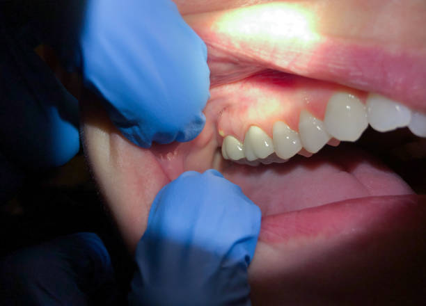 Best Emergency Treatment for Toothache in Lavaca, AR