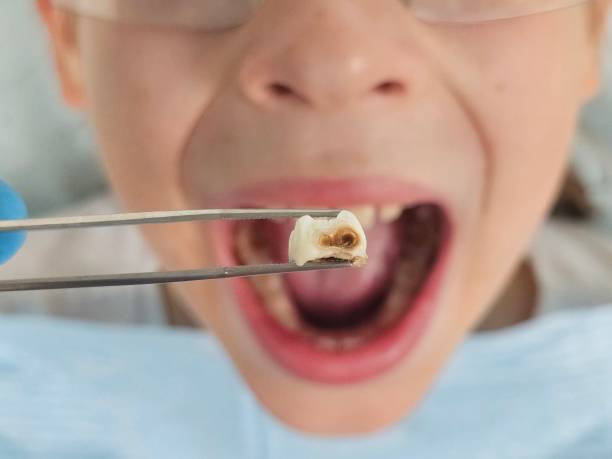 Best Pediatric Emergency Dentist in Lavaca, AR